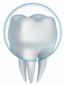 Dental crown