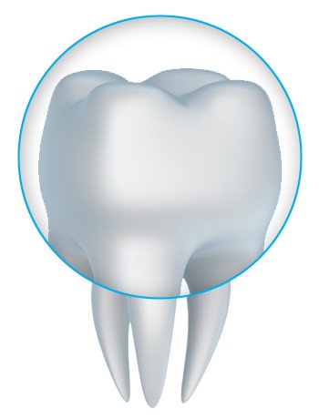 Porcelain Crowns Restore Smiles for Philpot