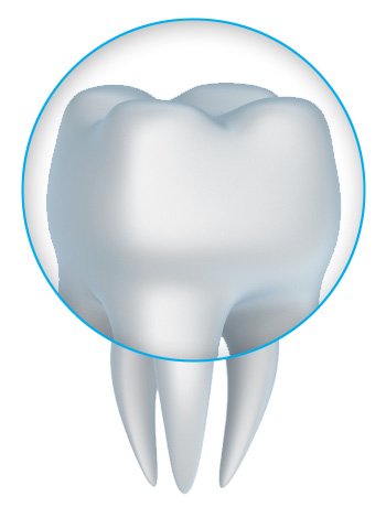 CEREC Porcelain Crowns Restore Smiles for Philpot