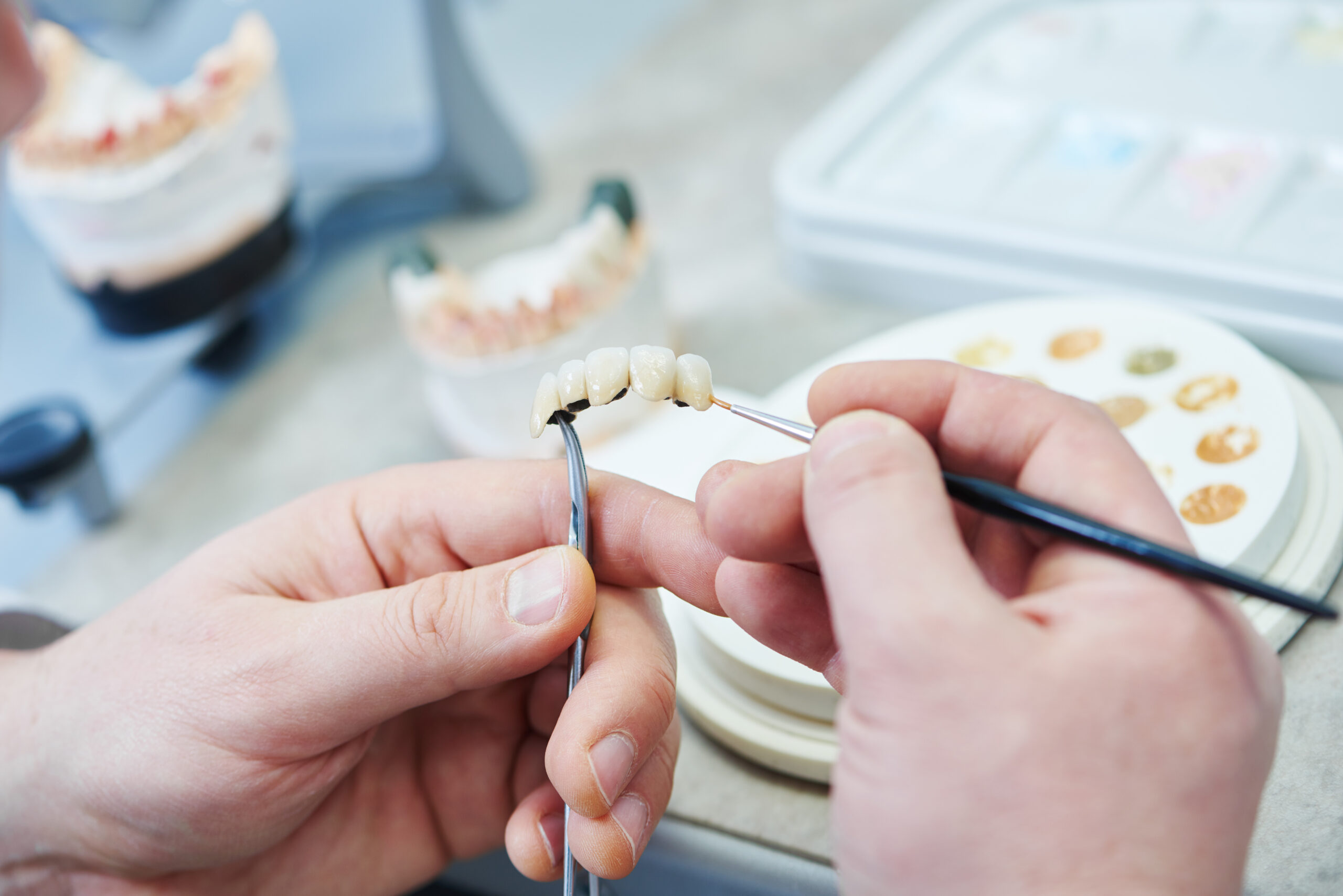 dentist holding a dental bridge, closeup